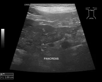 강아지 복막염 원인과 치료 방법_7