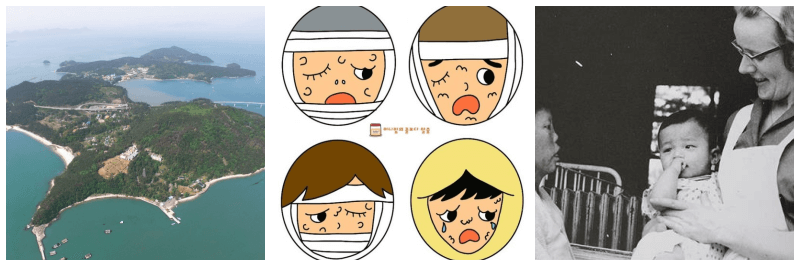 소록도&#44; 한센병 사진