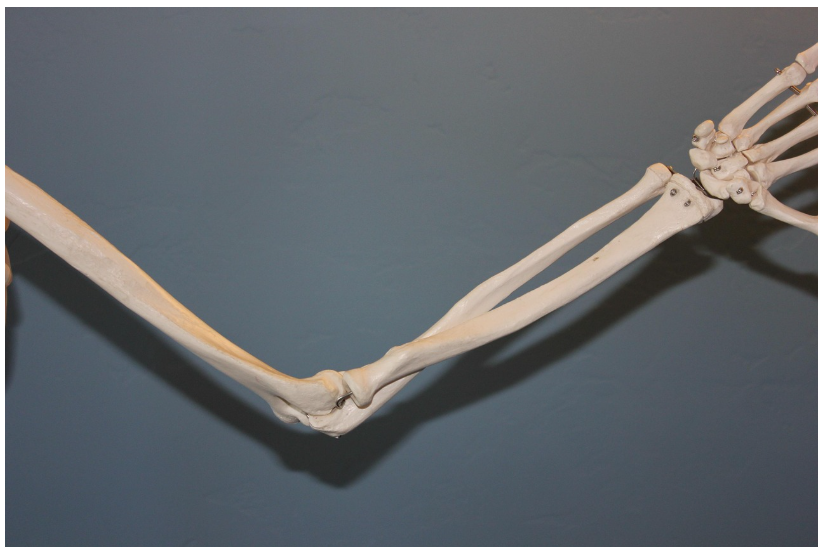 골수염(osteomyelitis) 완전 정복: 원인, 증상, 진단, 치료와 예방까지