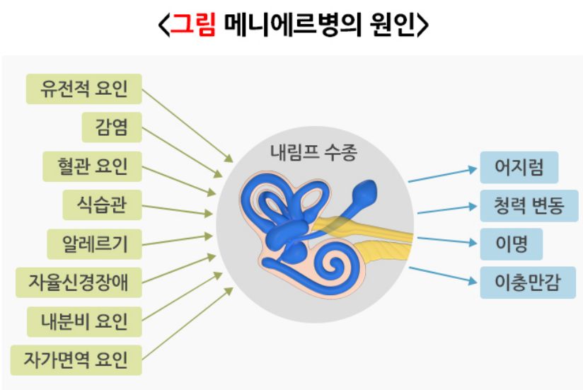 메니에르병