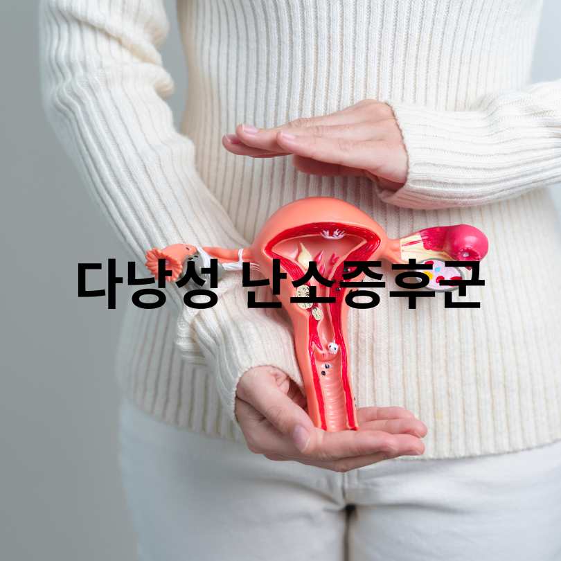 다낭성 난소증후군 증상과 좋은 음식 총정리