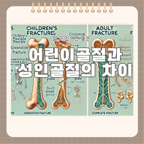 뼈골절 수술비용