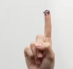 무좀 증상 치료법 원인 발톱 손톱