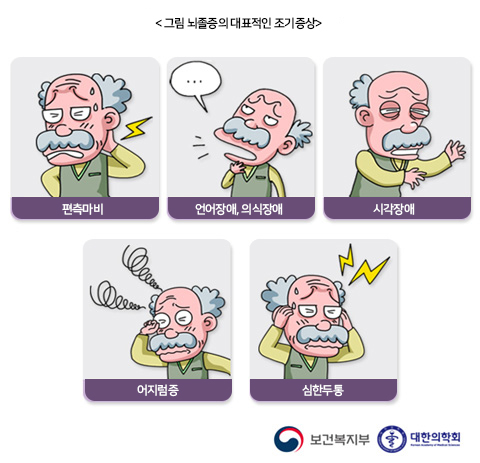 뇌졸중의 대표적인 전조 증상, 뇌졸중 조기 증상, 뇌졸중 초기 증상