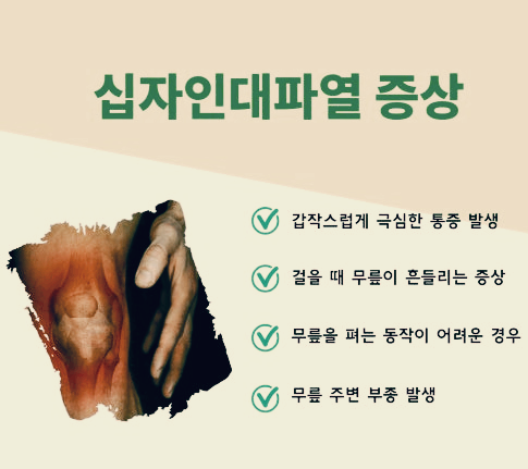 십자인대파열 증상