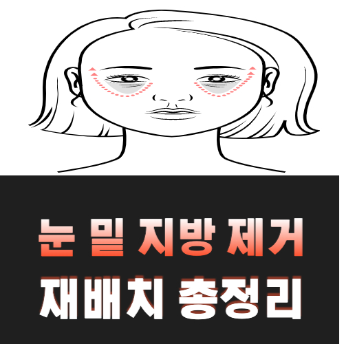 눈-밑-지방-제거
