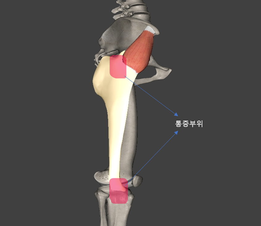 장경인대