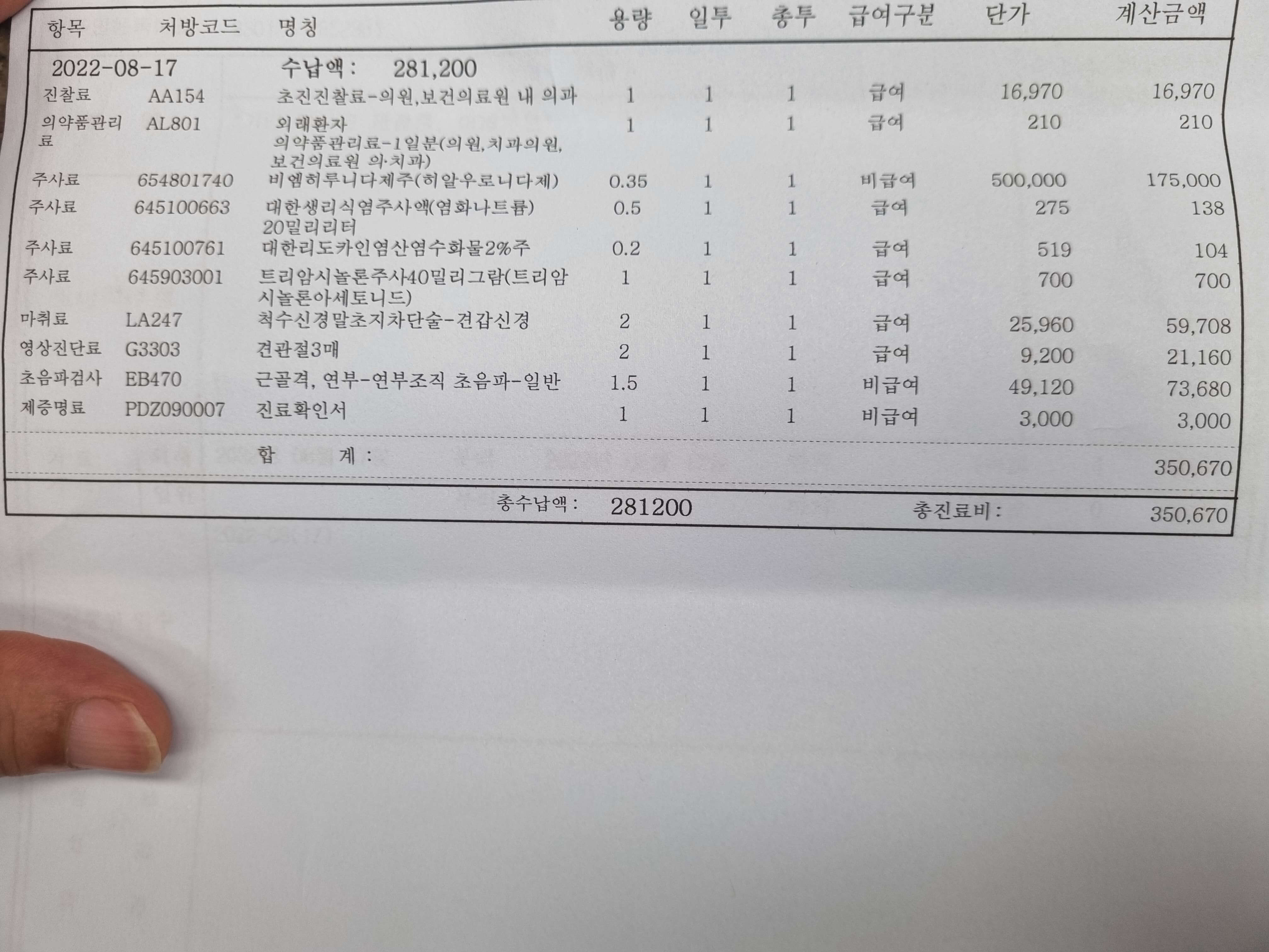 비용
