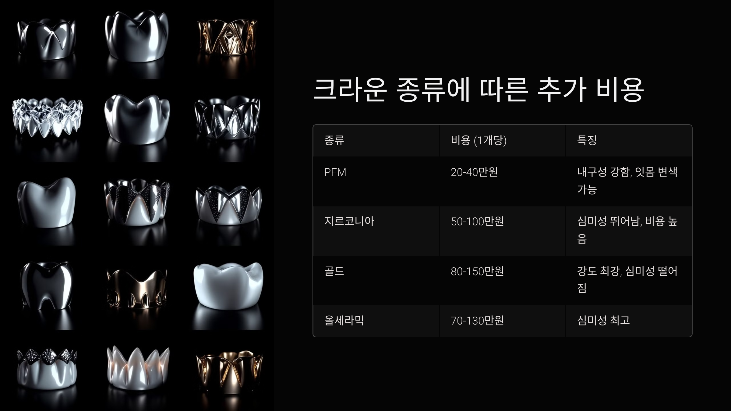 크라운 종류에 따른 추가 비용