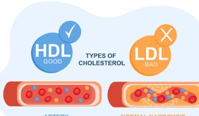 hdl 콜레스테롤 이란? 정상수치 및 높이는 방법