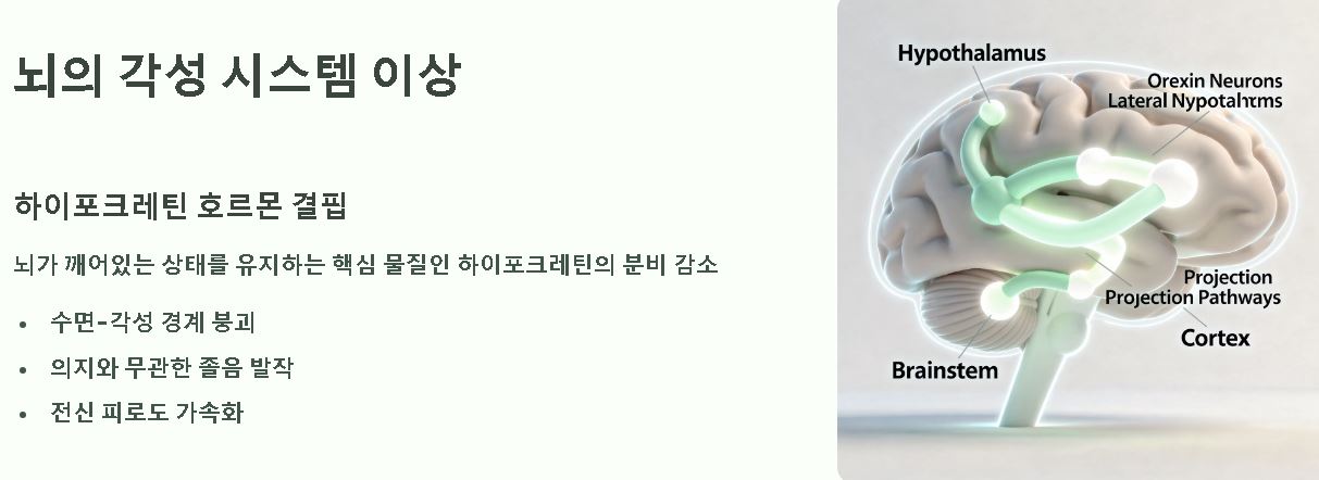 잠이 계속 오는 이유