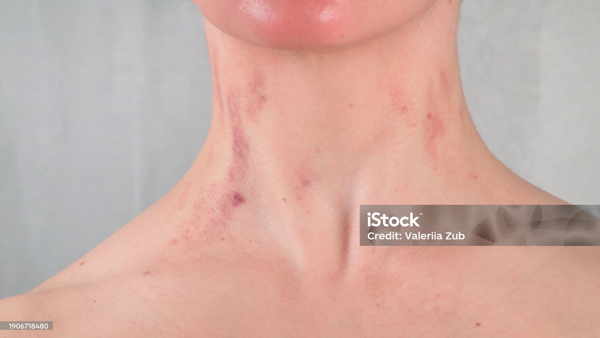 목에 멍울이 잡힐때&amp;#44; 그냥 두면 위험할까요?