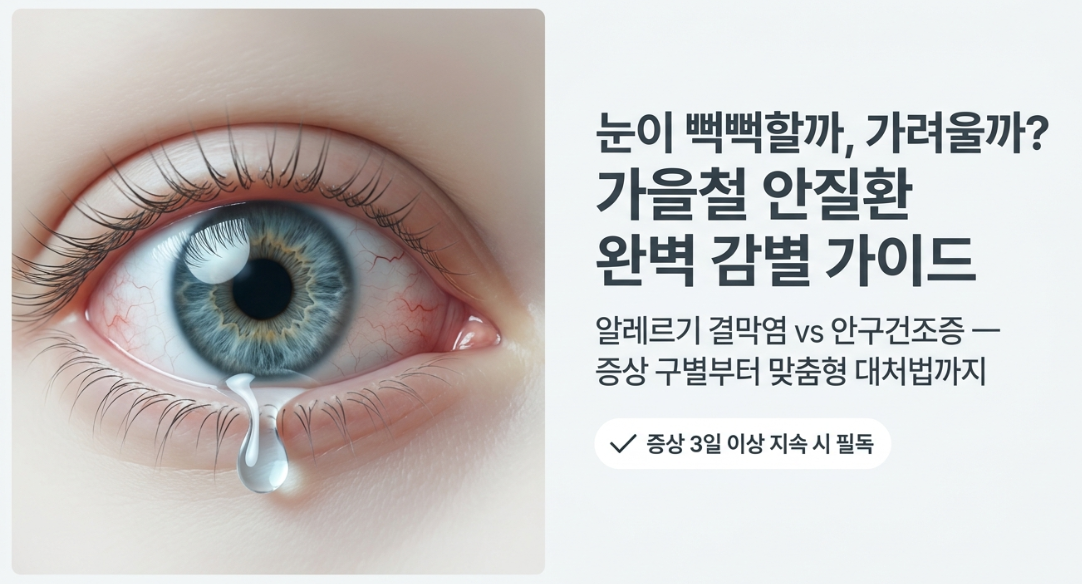 "눈이 뻑뻑할까 가려울까?" 가을철 알레르기 결막염과 안구건조증 증상 구별법 총정리
