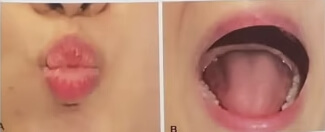 코골이예방운동4