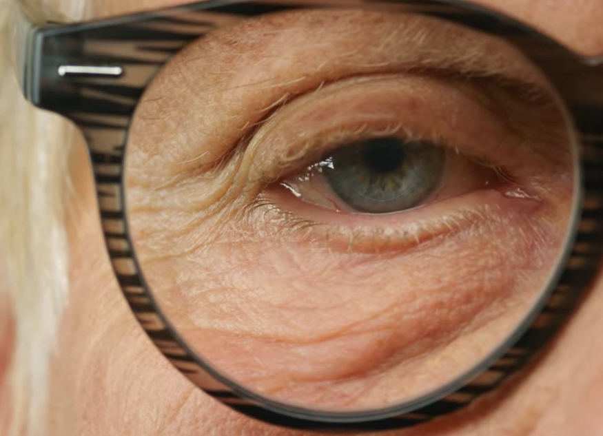 녹내장 초기증상