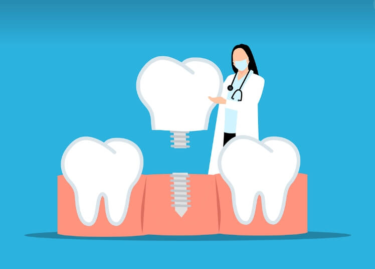 임플란트 뼈이식 과정