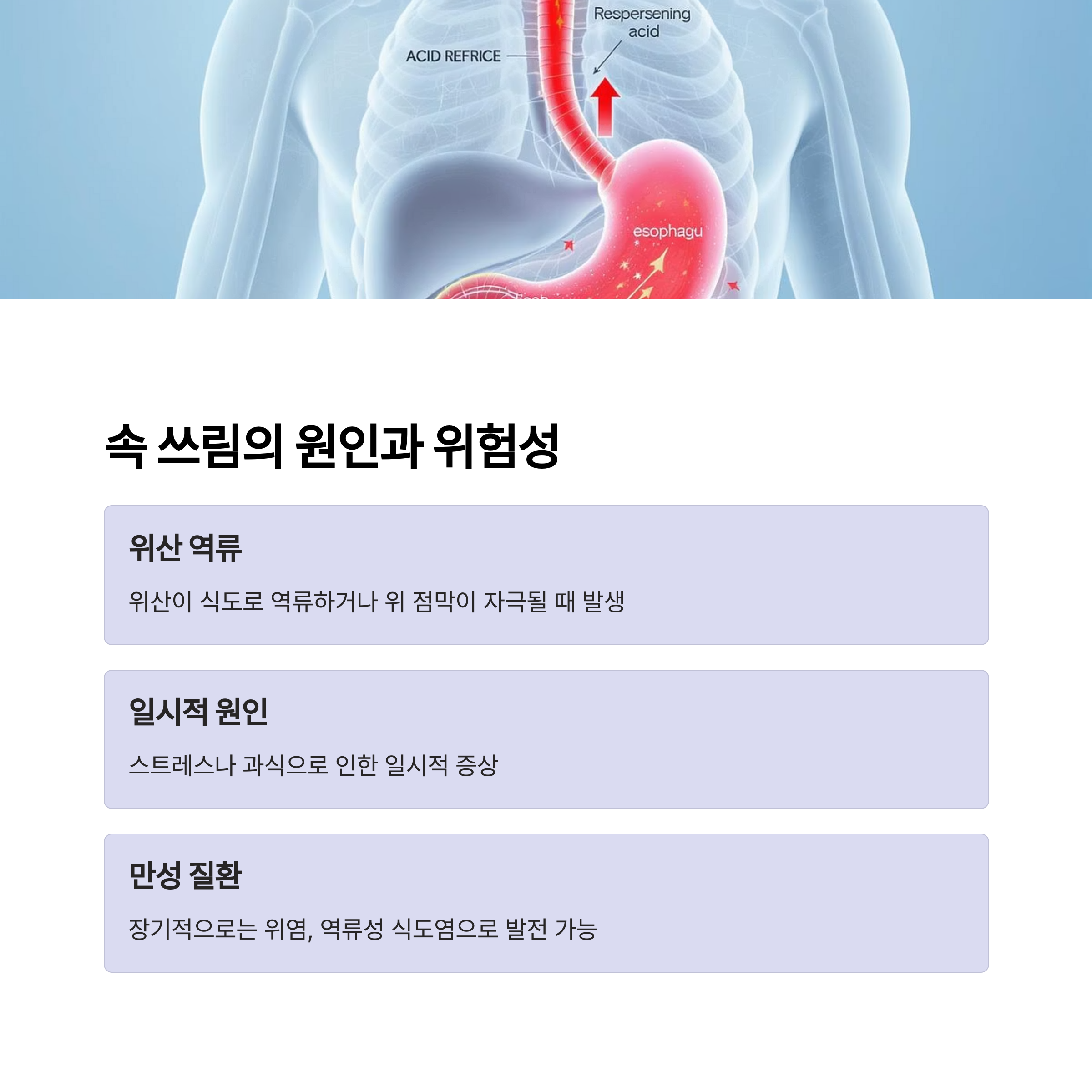 속 쓰림 원인과 위험성
