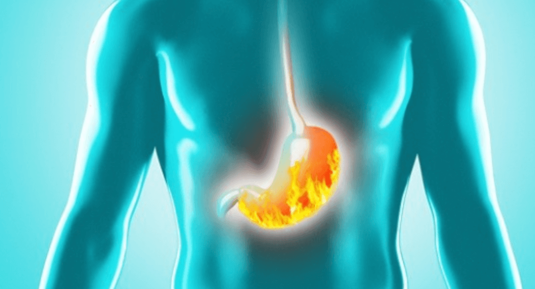 가슴 중앙 통증 위