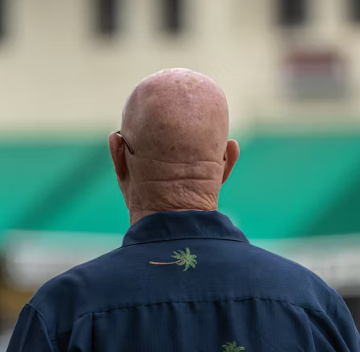 전립선 비대증 치료 방법 진단 기준 예방법