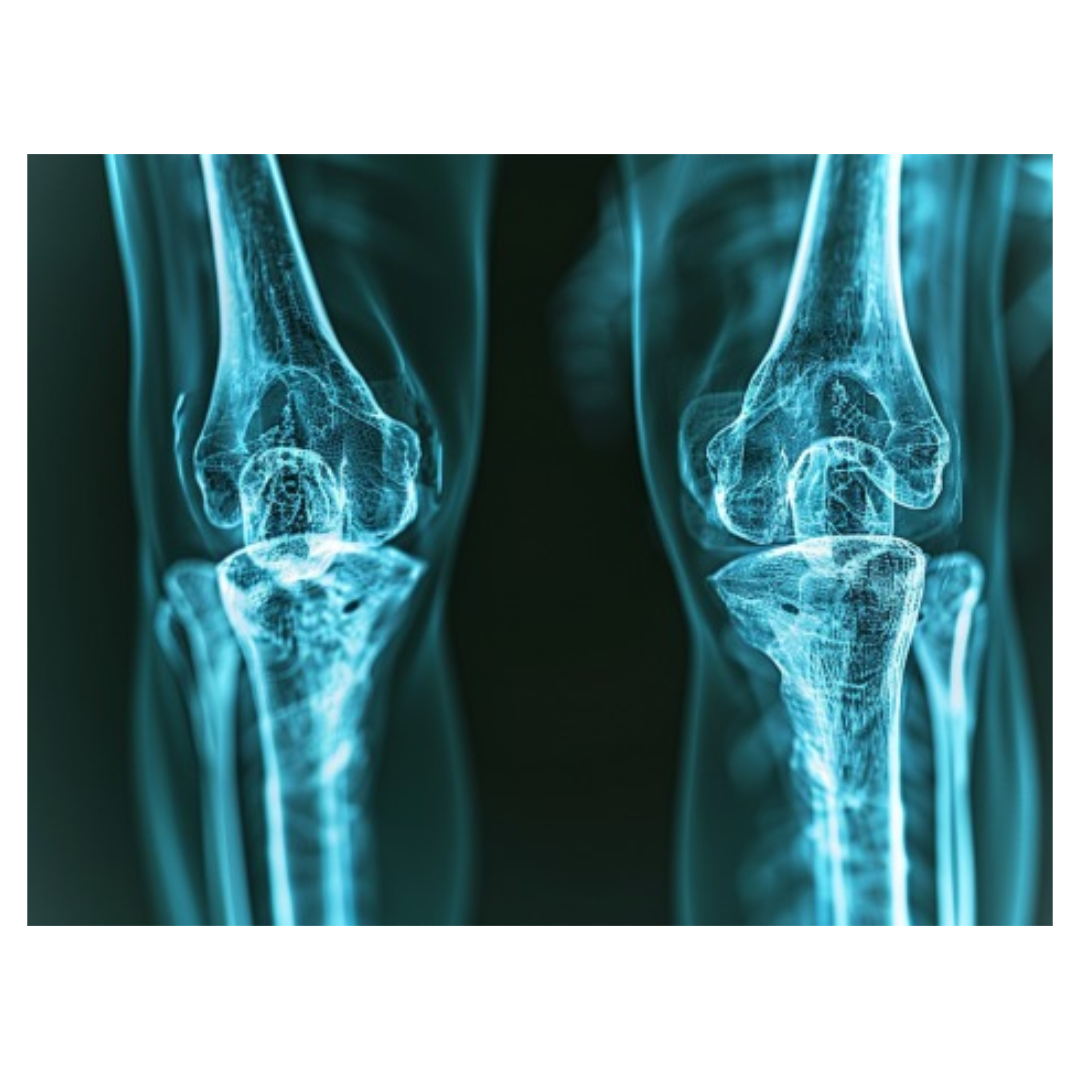 통풍과 관련된 사진입니다.