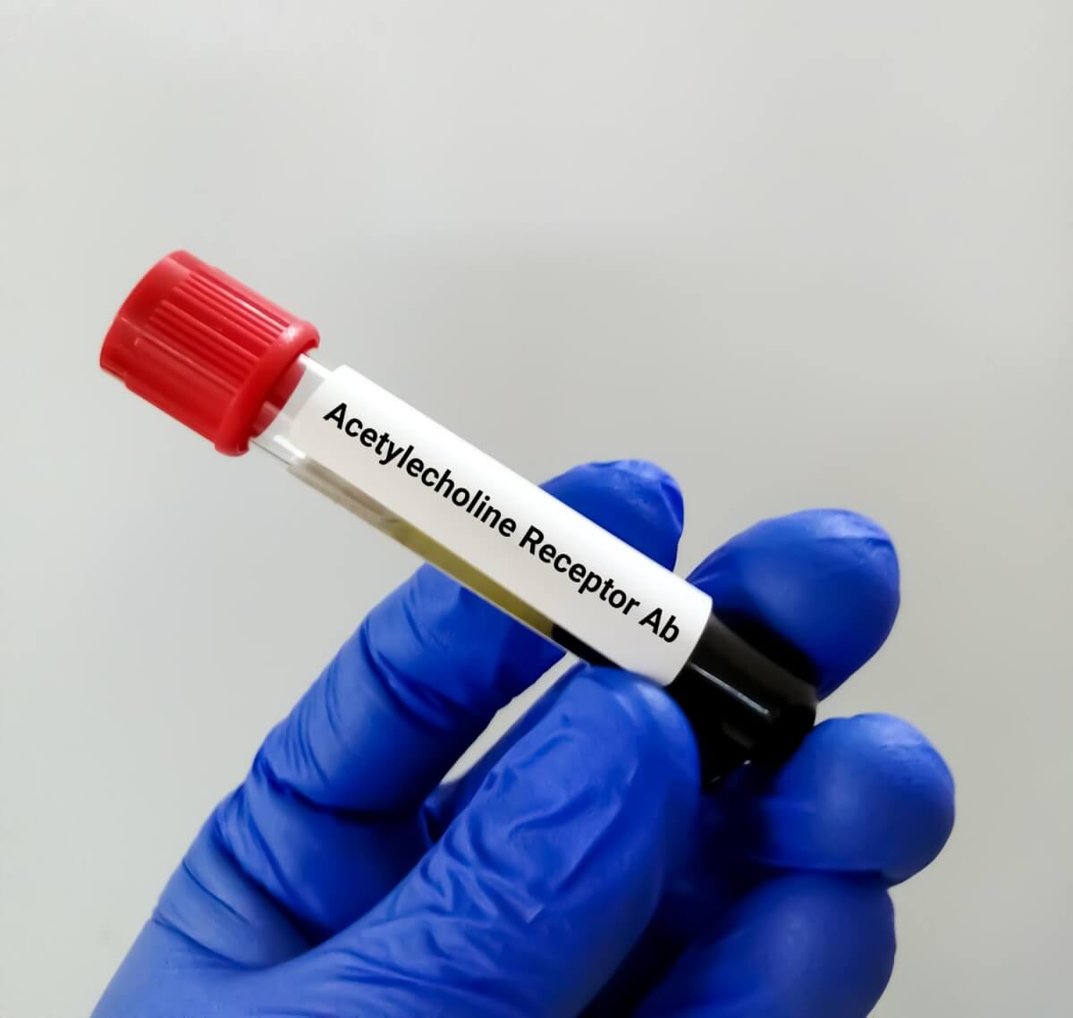 아세틸콜린-수용체