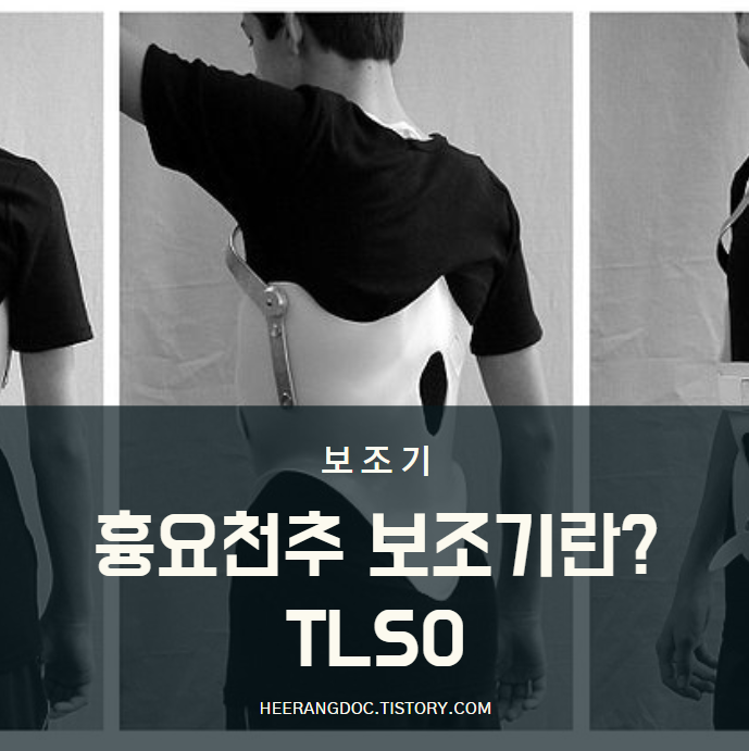 TLSO란?