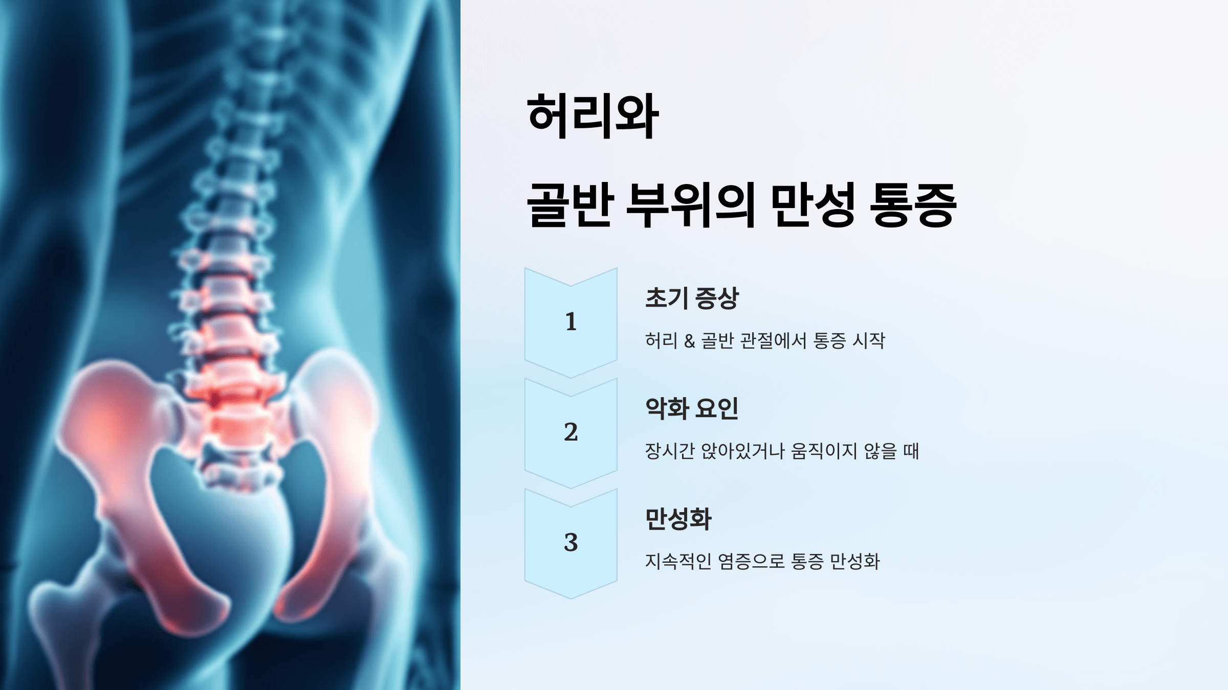 강직성 척추염과 관련된 사진입니다.
