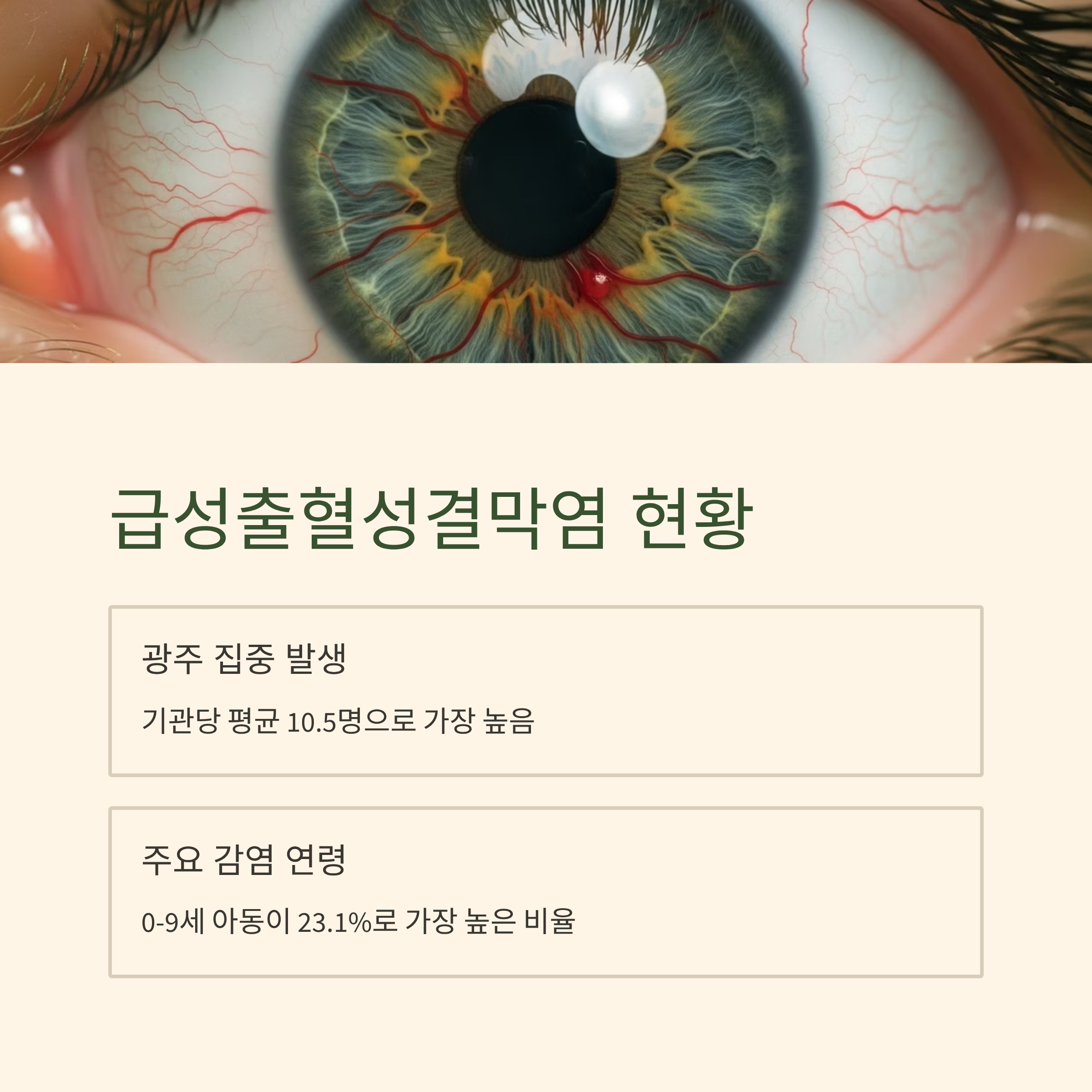 급성출혈성결막염 현황