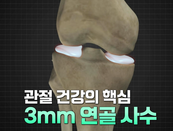 콘드로이친