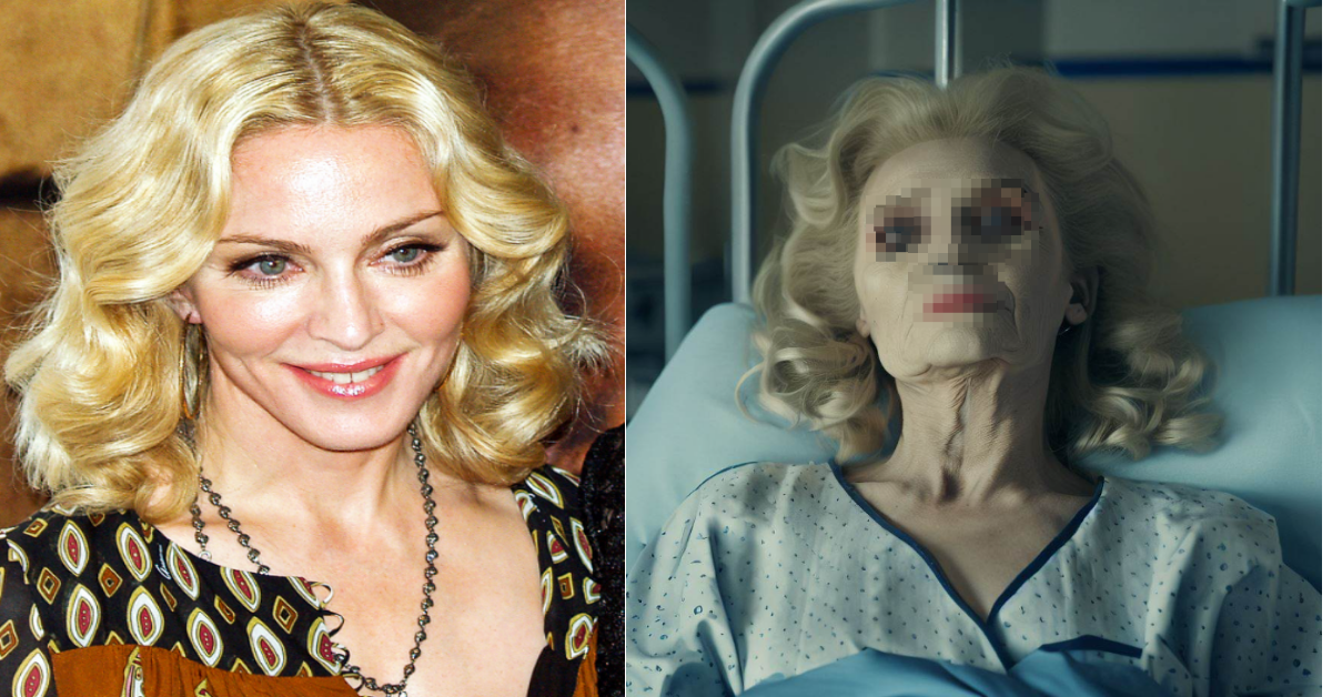 64세 팝가수 마돈나, '이것' 때문에 의식 잃고 쓰러져... 중환자실에 입원한 안타까운 근황