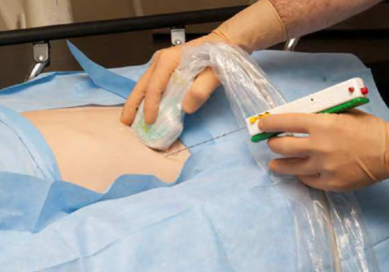 사구체신염의 치료법