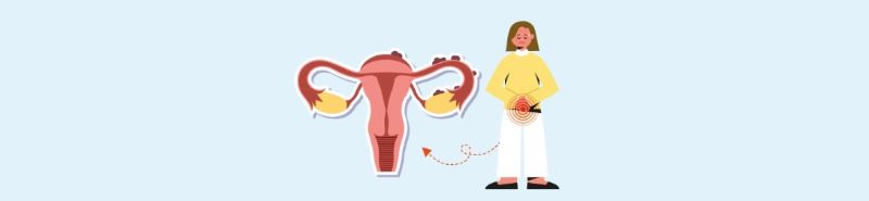 자궁내막증 관련 일러스트 이미지 < 출처 : AIA >