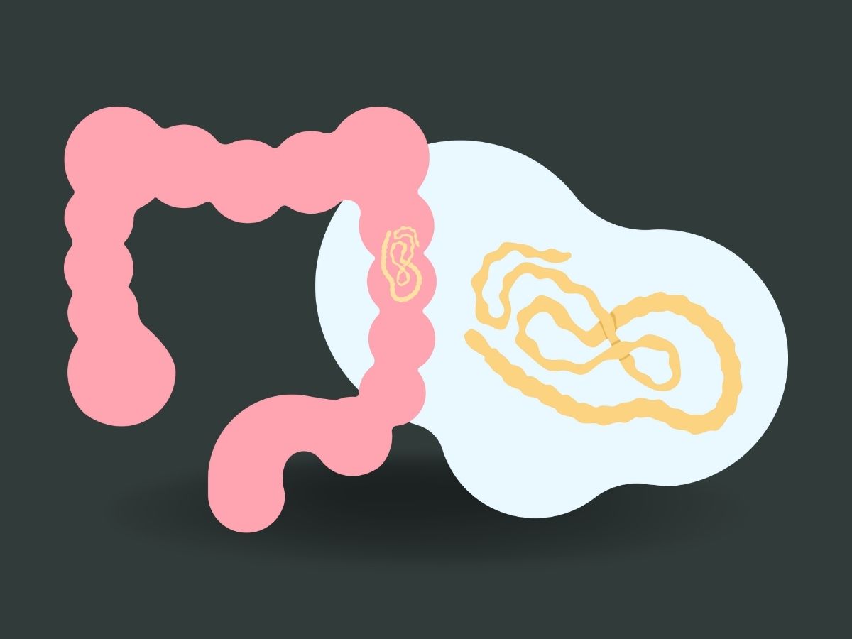 강아지 내부기생충