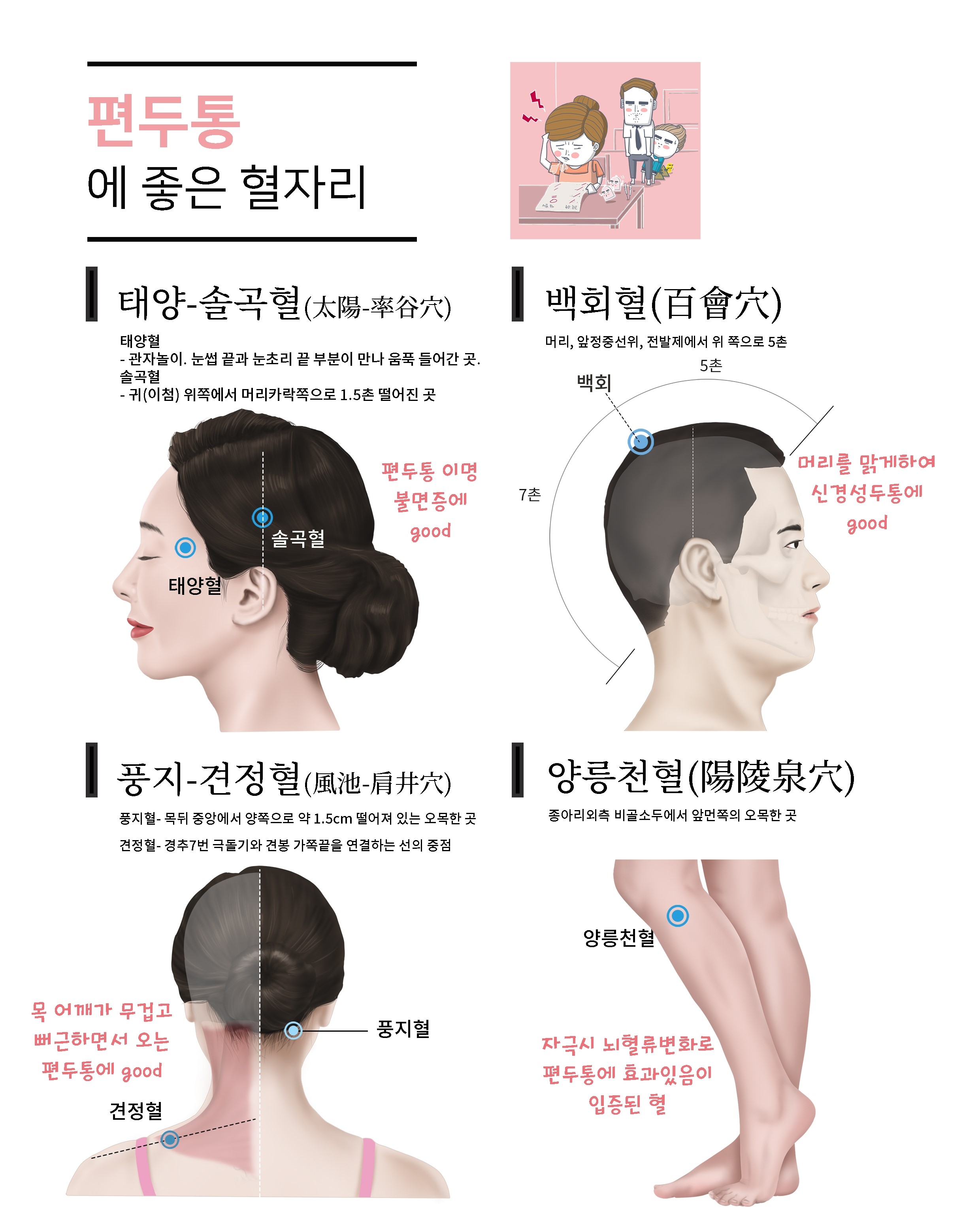 편두통 없애주는 가라앉히는 방법 편두통 영양제 지압 혈자리 완화
