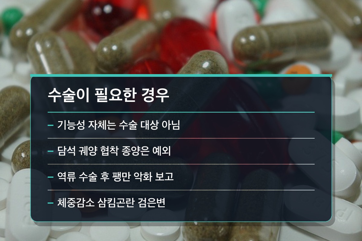 기능성 소화불량 수술 여부 그래도 수술이 필요한 경우는 정말 없을까요?