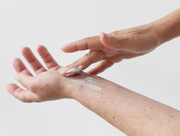 대상포진 초기증상 13