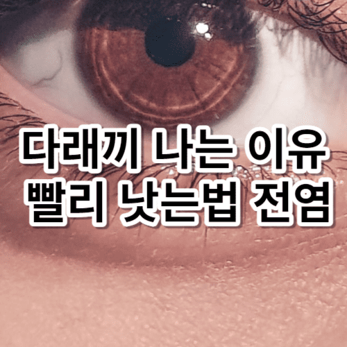 다래끼 나는 이유 났을때 좋은 음식