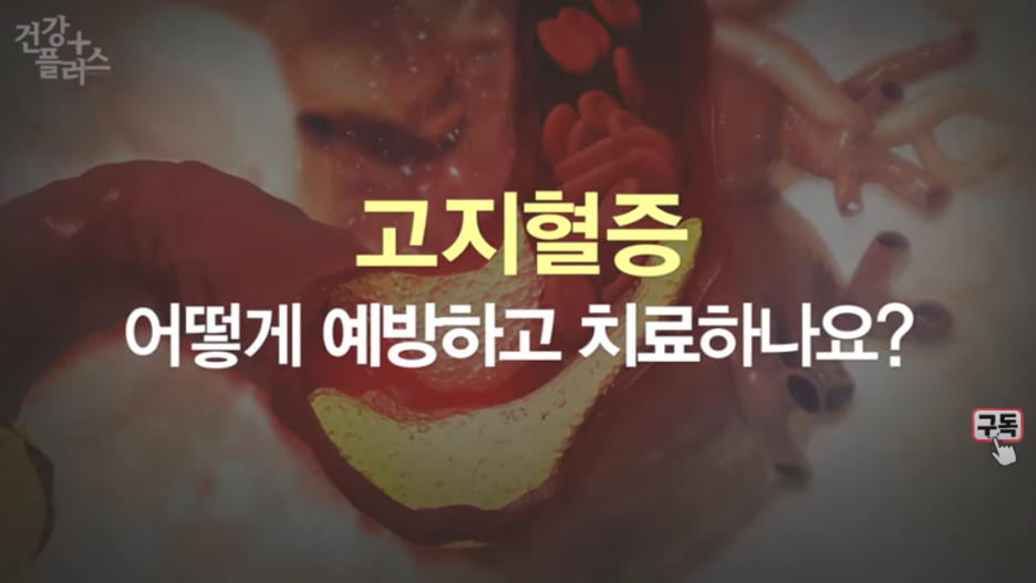 고지혈증 증상, 고지혈증좋은음식, 나쁜 음식 일상생활속 관리법