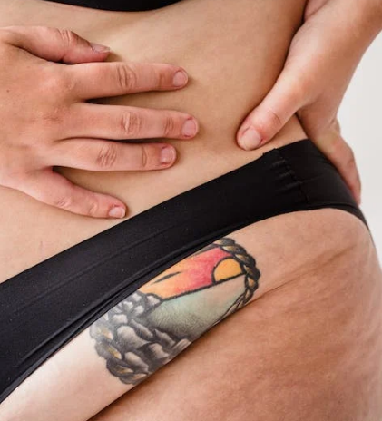 여성-셀룰라이트