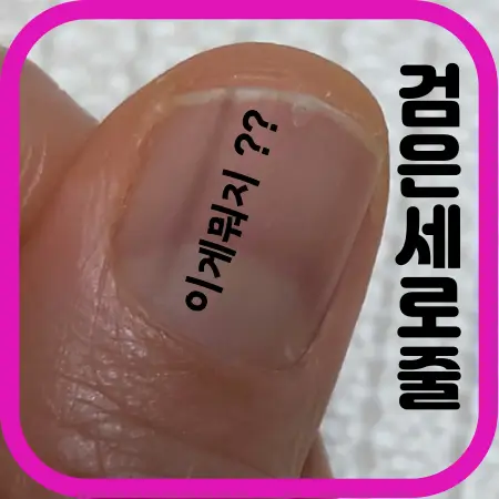 이게뭐지-검은-세로줄