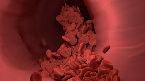 췌장암 초기증상 37