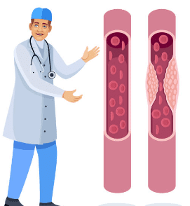 hdl 콜레스테롤 이란? 정상수치 및 높이는 방법