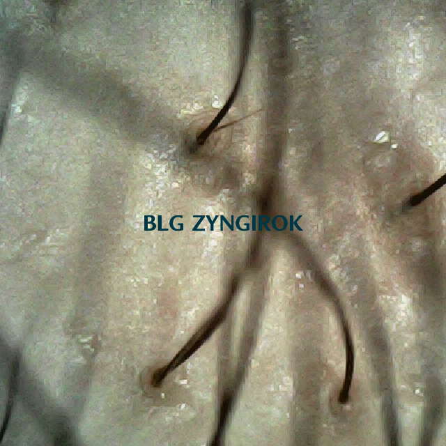 피나모아 복용 6주차 두피사진 - 정수리와 이마 사이부분 모습이다.