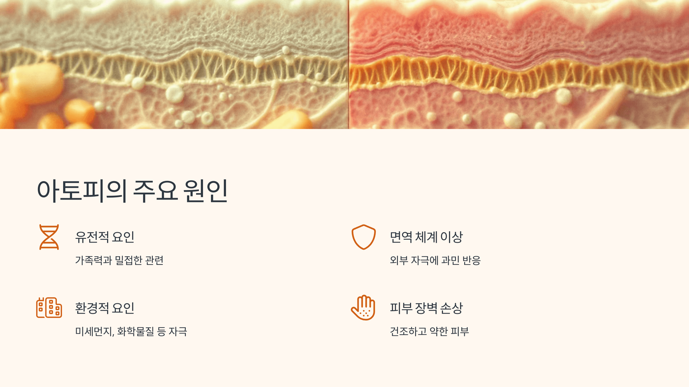 아토피 원인