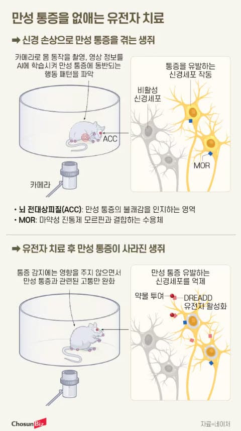 💉다치지 않았는데도 계속 아픈 이유, 만성 통증의 실체