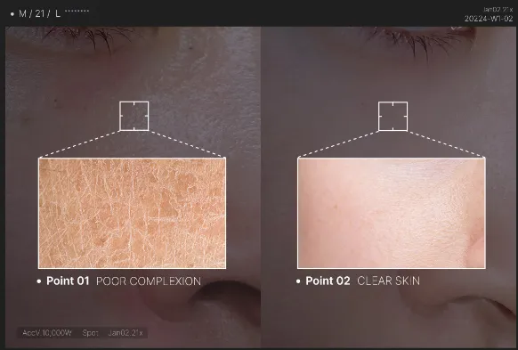 메디큐브 부스터힐러 효과