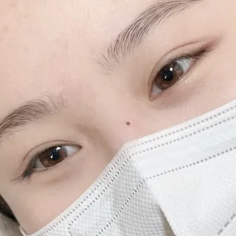 눈과 눈사이 점 관상 의미와 해석_14