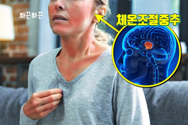 얼굴 안면 홍조,붉어짐 증상,갱년기 얼굴 열오르는 증상,생로병사의비밀