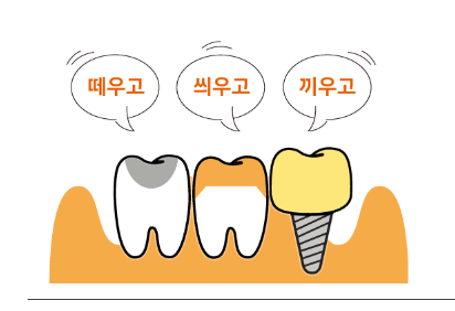 치아보험료 확인