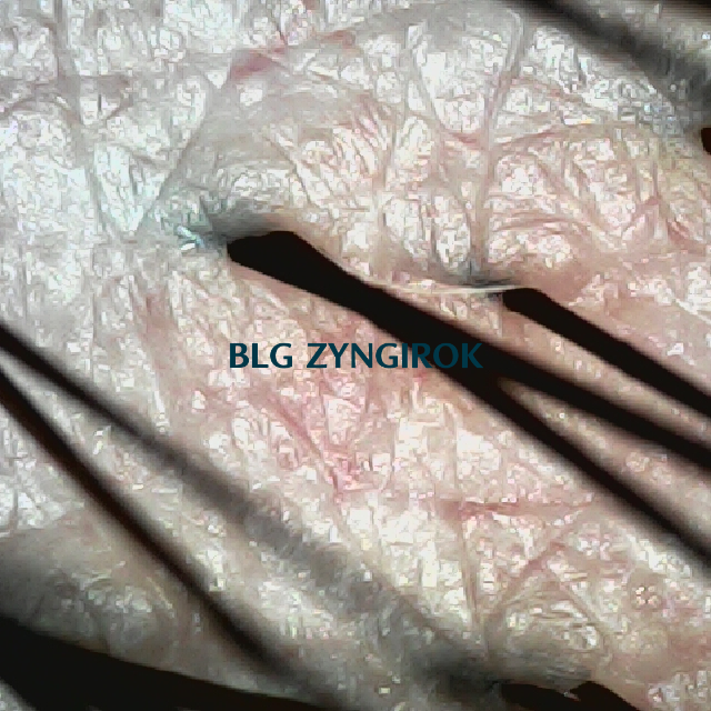 피나모아 복용 27주차 - 오른쪽 뒷머리 두피모습이다.